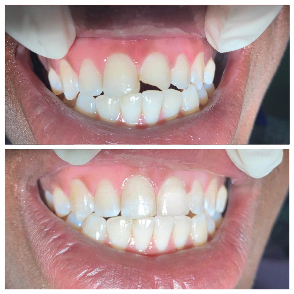 PHOTO-2020-06-11-23-50-45