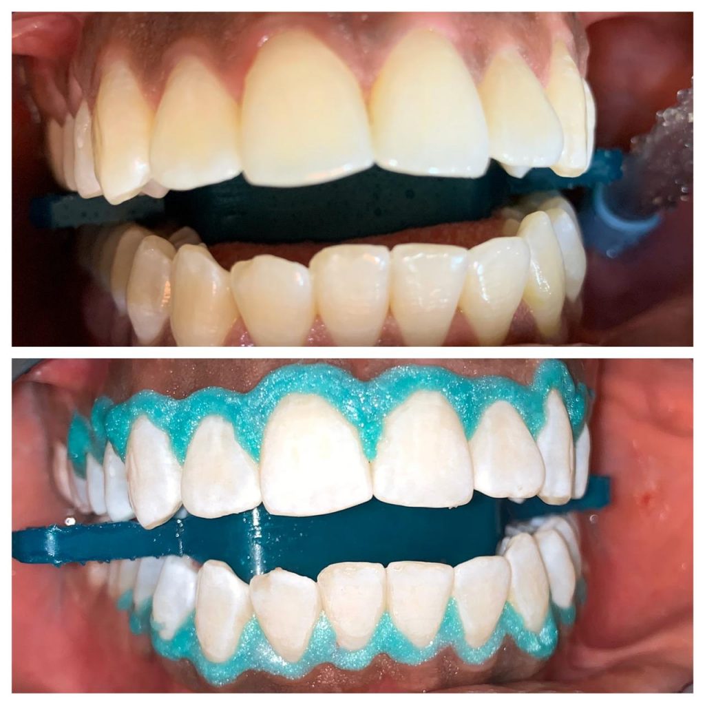 PHOTO-2020-06-11-23-50-45 – Copy