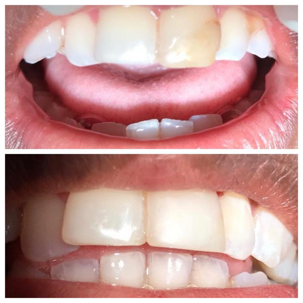 PHOTO-2020-06-11-23-50-51